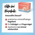 AMOROLFIN Dexcel 50 mg/ml wirkstoffhalt.Nagellack